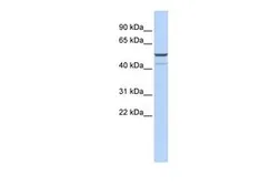 Anti-KCNK12 antibody, Internal used in Western Blot (WB). GTX47654