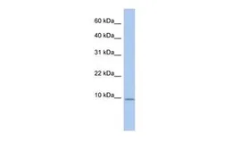 Anti-FXYD7 antibody, N-term used in Western Blot (WB). GTX47657