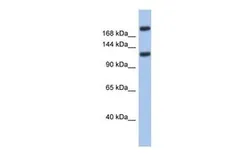 Anti-Cav3.3 antibody, Internal used in Western Blot (WB). GTX47661