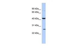 Anti-KCNMB4 antibody, Internal used in Western Blot (WB). GTX47677