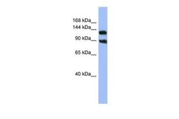 Anti-KCNH3 antibody, Internal used in Western Blot (WB). GTX47679