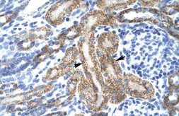 Anti-KCNA10 antibody, Internal used in IHC (Paraffin sections) (IHC-P). GTX47683
