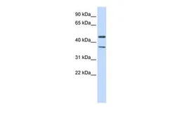 Anti-KIR2.3 antibody, Internal used in Western Blot (WB). GTX47688