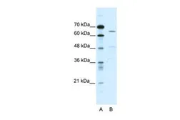 Anti-ACCN1 antibody, C-term used in Western Blot (WB). GTX47700