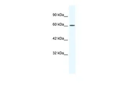 Anti-Cav beta 2 antibody, Internal used in Western Blot (WB). GTX47706