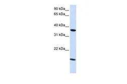 Anti-Claudin 16 antibody, C-term used in Western Blot (WB). GTX47761