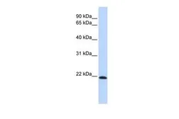 Anti-Claudin 7 antibody, Internal used in Western Blot (WB). GTX47766
