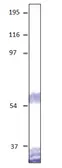Anti-Dopamine Receptor D5 antibody used in Western Blot (WB). GTX47806
