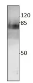 Anti-Thickvein antibody used in Western Blot (WB). GTX47856