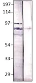 Anti-Bestrophin 4 antibody used in Western Blot (WB). GTX47908