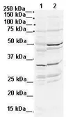 Anti-DLX2 antibody, N-term used in Western Blot (WB). GTX48461