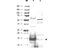 Anti-UBE2N antibody used in Western Blot (WB). GTX48485