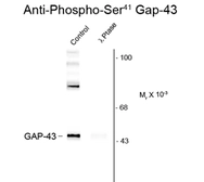 Anti-GAP43 (phospho Ser41) antibody used in Western Blot (WB). GTX48610