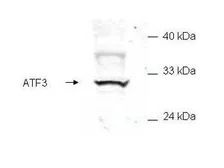 Anti-ATF3 antibody used in Western Blot (WB). GTX48669