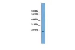 Anti-NSG1 antibody, N-term used in Western Blot (WB). GTX49020