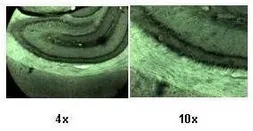 Anti-KCNN2 antibody, C-term used in IHC (Paraffin sections) (IHC-P). GTX49068