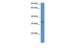 Anti-JMJD8 antibody, C-term used in Western Blot (WB). GTX49113