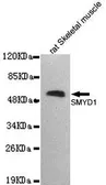 Anti-SMYD1 antibody [2E11-B6-C7] used in Western Blot (WB). GTX49237