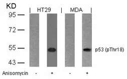 Anti-p53 (phospho Thr18) antibody used in Western Blot (WB). GTX50159