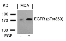 Anti-EGFR (phospho Tyr845) antibody used in Western Blot (WB). GTX50264