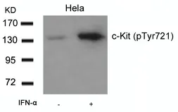 Anti-c-kit (phospho Tyr721) antibody used in Western Blot (WB). GTX50271
