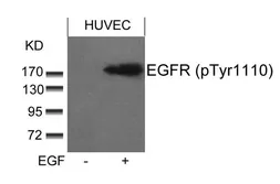 Anti-EGFR (phospho Tyr1086) antibody used in Western Blot (WB). GTX50289