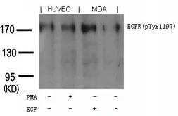 Anti-EGFR (phospho Tyr1173) antibody used in Western Blot (WB). GTX50358