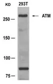 Anti-ATM antibody used in Western Blot (WB). GTX50488