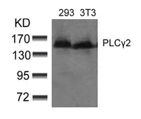 Anti-PLCG2 antibody used in Western Blot (WB). GTX50517