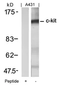 Anti-c-kit antibody used in Western Blot (WB). GTX50556