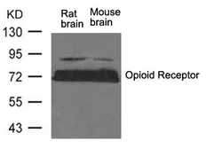Anti-Mu Opioid receptor antibody used in Western Blot (WB). GTX50619