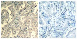 Anti-STAT2 antibody used in IHC (Paraffin sections) (IHC-P). GTX50661