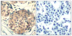 Anti-c-kit antibody used in IHC (Paraffin sections) (IHC-P). GTX50708