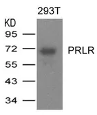 Anti-Prolactin Receptor antibody used in Western Blot (WB). GTX50723