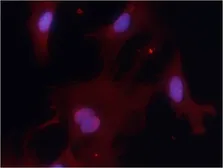 Anti-PKM1 antibody used in Immunocytochemistry/ Immunofluorescence (ICC/IF). GTX50734