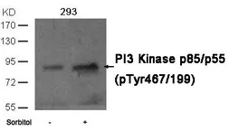 Anti-PI3 kinase p85 (phospho Tyr467) / p55 (phospho Tyr199) antibody used in Western Blot (WB). GTX50858