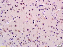 Anti-GRID2IP antibody used in IHC (Paraffin sections) (IHC-P). GTX51075