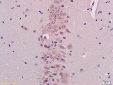 Anti-BHLHB9 antibody used in IHC (Paraffin sections) (IHC-P). GTX51145