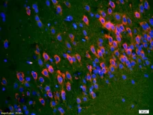 Anti-SYTL5 antibody used in IHC (Paraffin sections) (IHC-P). GTX51590