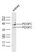 Anti-PDGFC antibody used in Western Blot (WB). GTX51652