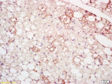 Anti-CLMP antibody used in IHC (Paraffin sections) (IHC-P). GTX51678