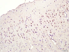 Anti-CNIH3 antibody used in IHC (Paraffin sections) (IHC-P). GTX51857