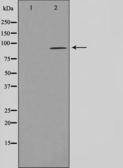 Anti-AHR antibody used in Western Blot (WB). GTX52358