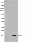 Anti-Histone H3 antibody used in Western Blot (WB). GTX52367