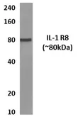 Anti-IL1RAPL1 antibody [3R16] used in Western Blot (WB). GTX52806