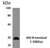 Anti-Ihh antibody, N-Term [9L16] used in Western Blot (WB). GTX53061
