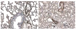 Anti-TGF beta Receptor I antibody [3A11] used in IHC (Paraffin sections) (IHC-P). GTX53107