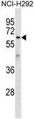 Anti-ATL1 antibody used in Western Blot (WB). GTX53498