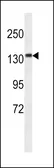 Anti-CAMSAP3 antibody used in Western Blot (WB). GTX53507