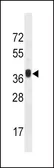 Anti-HB9 / HLXB9 antibody used in Western Blot (WB). GTX53647